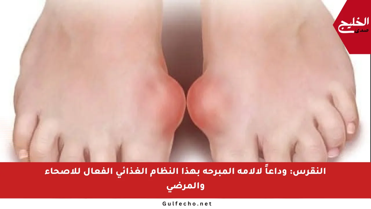 النقرس: وداعاً لآلامه المبرحة بهذا النظام الغذائي الفعال للأصحاء والمرضى